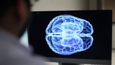 Beyin Çipi İlk Kez İnsanın Beynine Yerleştirildi !